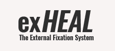 exHEAL - The External Fixation System