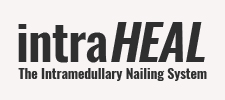 intraHEAL - The Intramedullary Nailing System