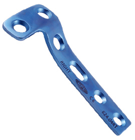 L - Buttress Plates